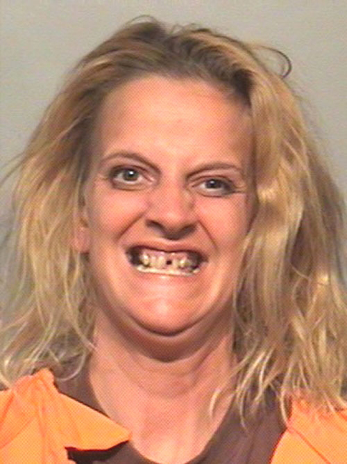 Image result for hillbilly woman missing a front tooth