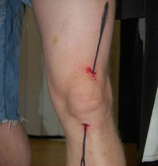 Arrow Through Knee – The Worst Bad Tattoos, The Ugliest Regrets, too.